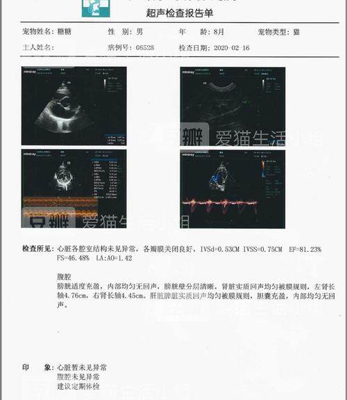 医生误做腹超被停工,医生误做腹超被停工怎么赔偿