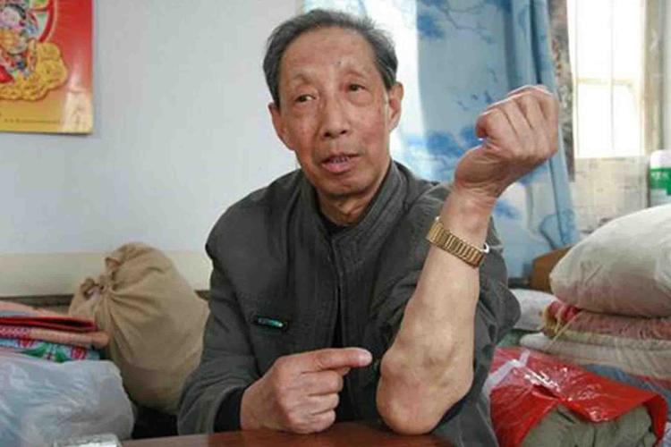 患瘤拒上夜班被开除,患瘤拒上夜班被开除有赔偿吗